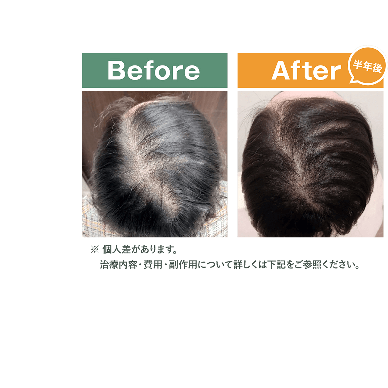 治療前・治療後