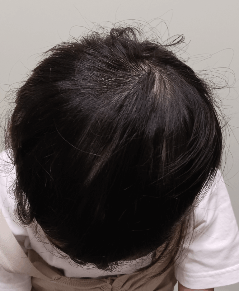 10才の女の子-4か月