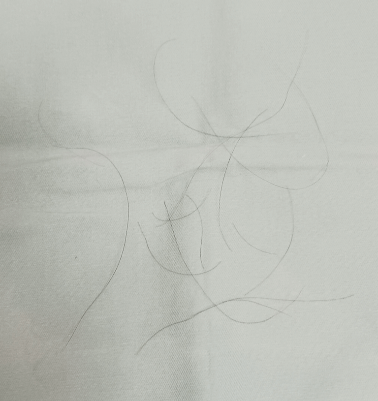 50代女性-初診時抜け毛