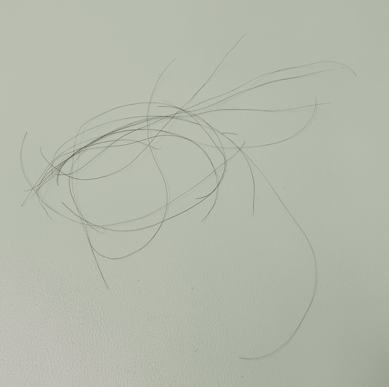 円形脱毛症-女性