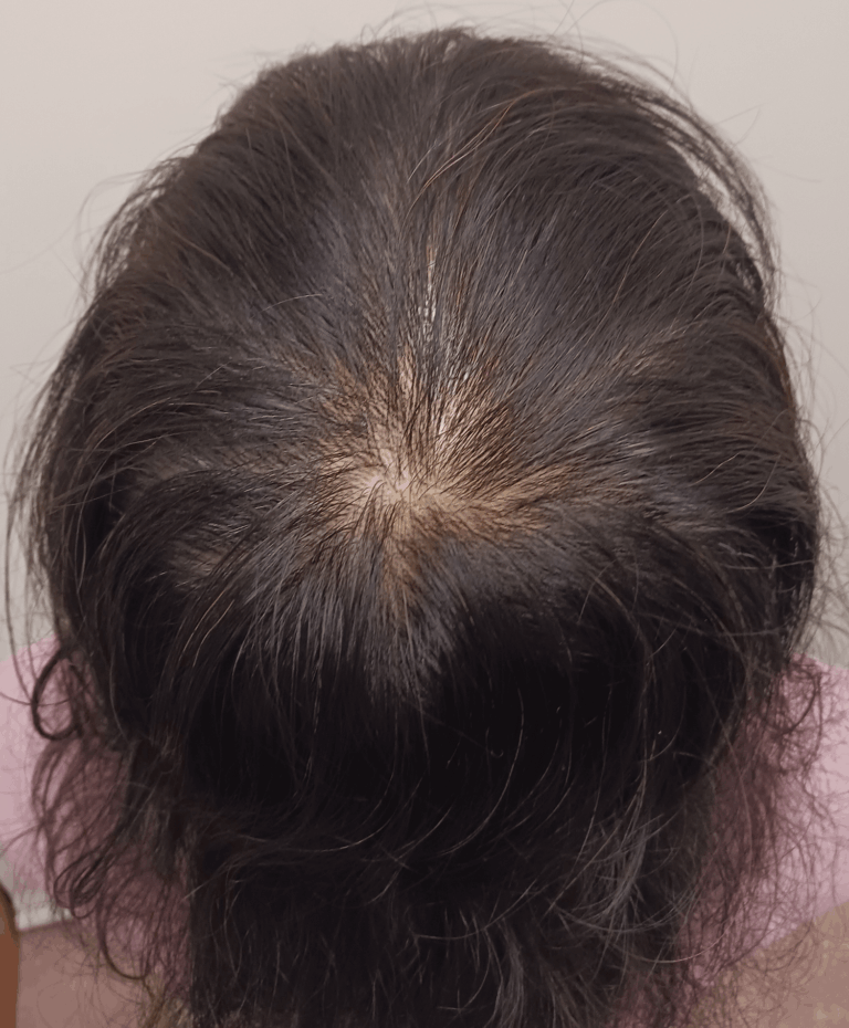 更年期女性 12か月後の経過