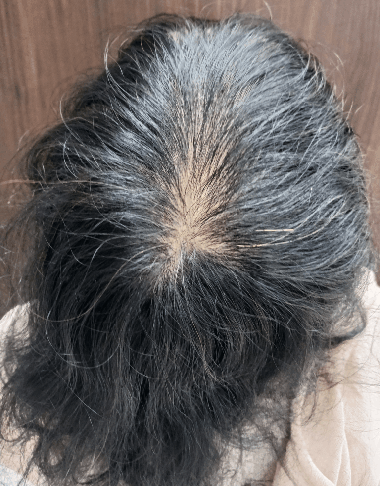 更年期女性 初診時